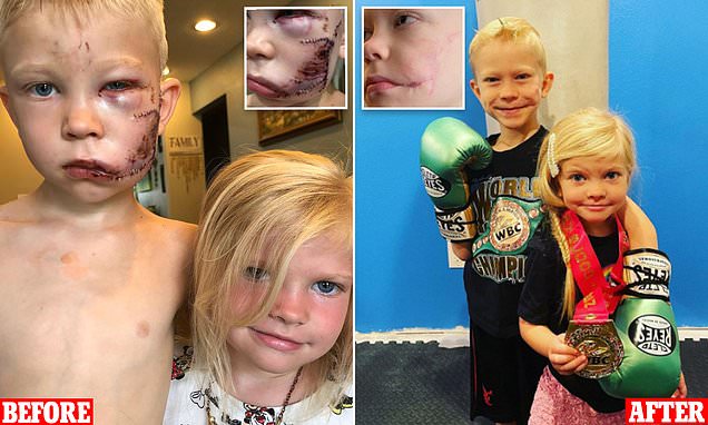 Bridger Walker: The Brave Big Brother Who Became a Real-Life Hero